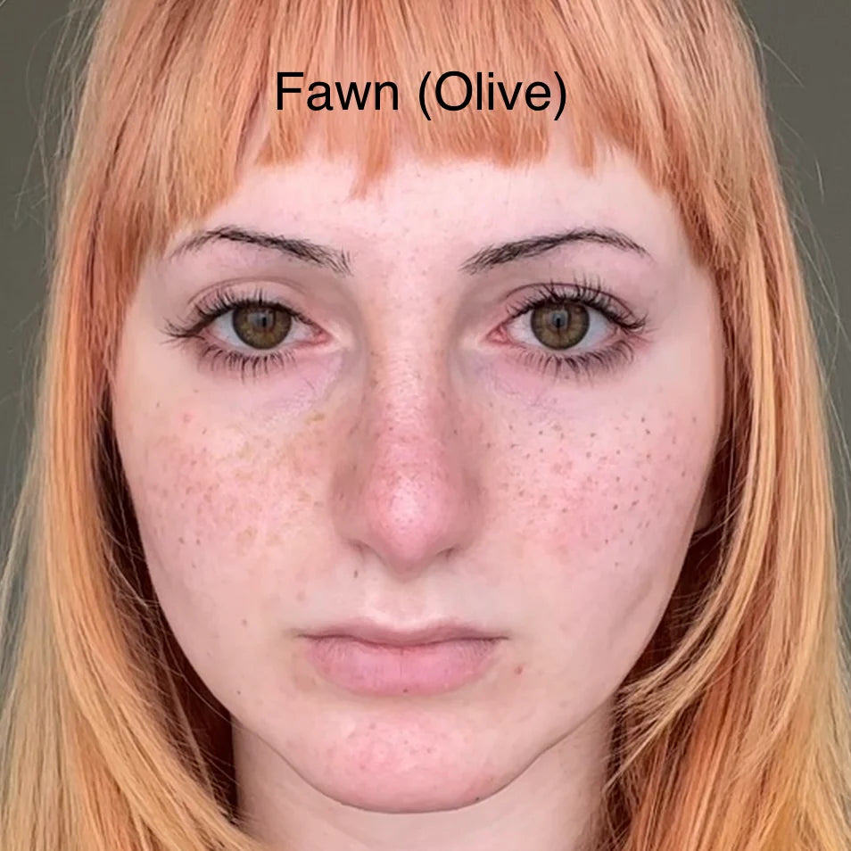 Freckle Pen