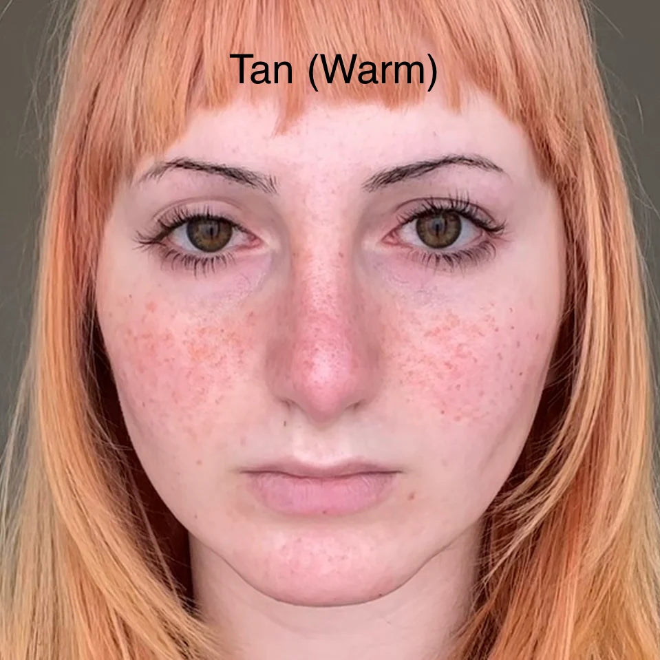 Freckle Pen